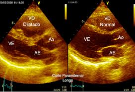 ecocardiograma bh
