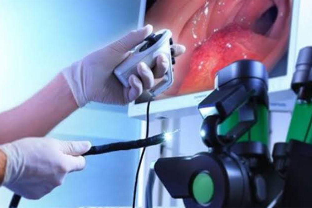 endoscopia bh