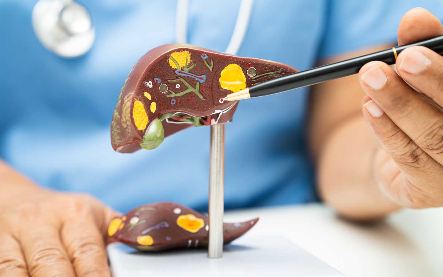 hepatologista bh