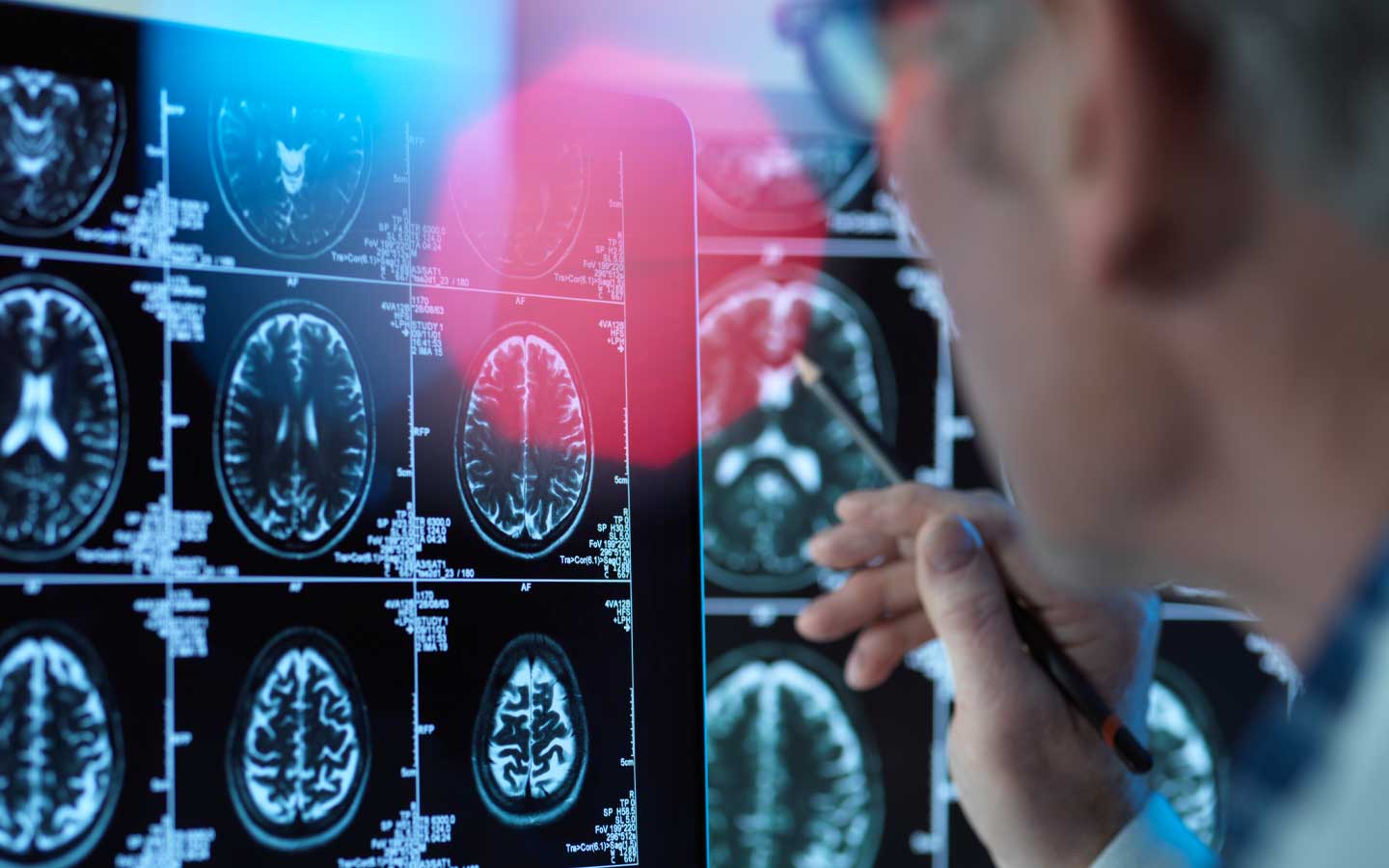 Neurologista BH